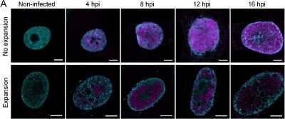 Immunocytochemistry/Immunofluorescence: Histone H3 [Trimethyl Lys9] Antibody [NB21-1073] - Chromatin distribution and nuclear volume of infected Vero cells. Confocal microscopy slices of unexpanded and expanded nuclei of non-infected and infected cells at 4, 8, 12, and 16 hpi. Chromatin was stained with a mixture of histone Abs (H3K27ac, H3K9me3, H4K20me3; cyan) and viral capsid protein with VP5 MAb (magenta). Scale bars are 5 um. Image collected and cropped by CiteAb from the following publication (//www.mdpi.com/1999-4915/11/10/935), licensed under a CC-BY license.